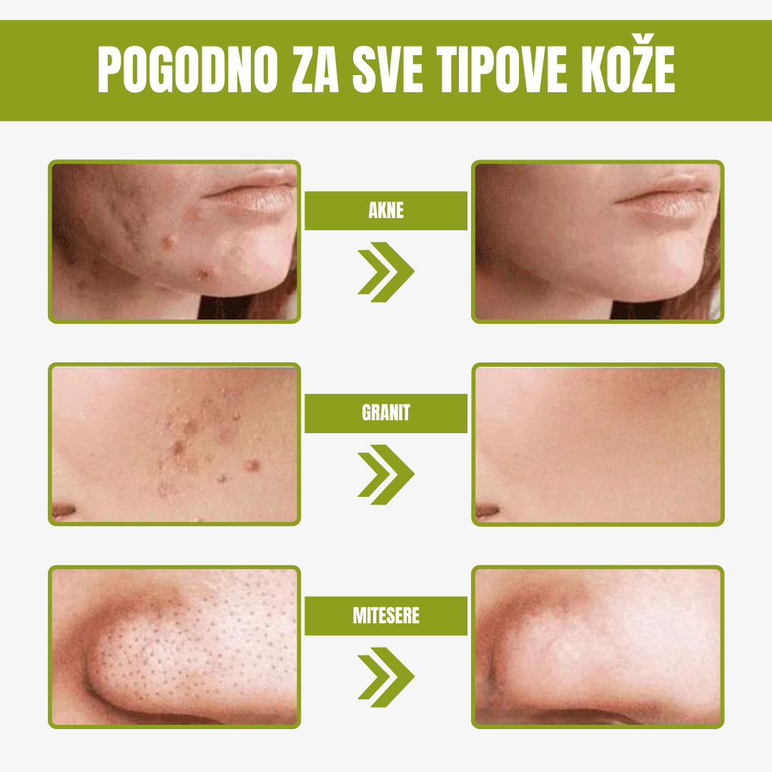 Zelena maska za lice 3 x 1 ponuda
